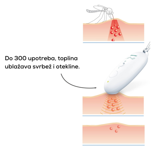 Beurer BR 10 aparat za pomoć pri ubodu i ugrizu insekata