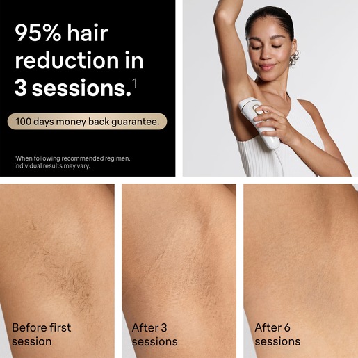 BRAUN IPL epilator PL5210 Silk·expert Pro 5, laserski