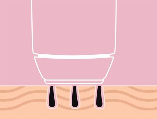 SmoothSkin Bare + IPL odstranjivač dlačica crni