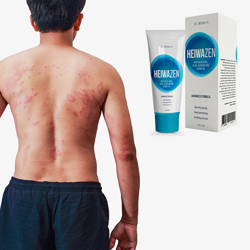 HeiwaZEN krema za kožne probleme