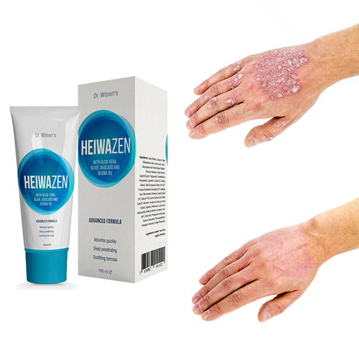 HeiwaZEN krema za kožne probleme