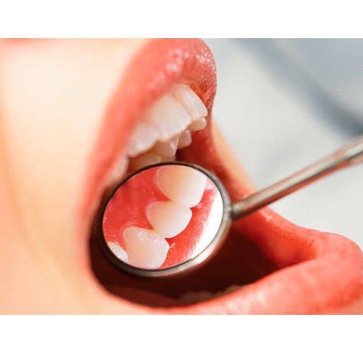 Philips Sonicare Healthy White električna četkica HX6762/43