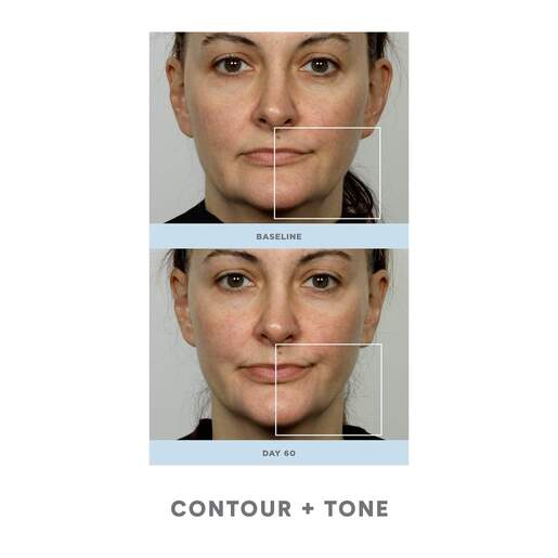 NUFACE TRINITY uređaj za toniranje lica