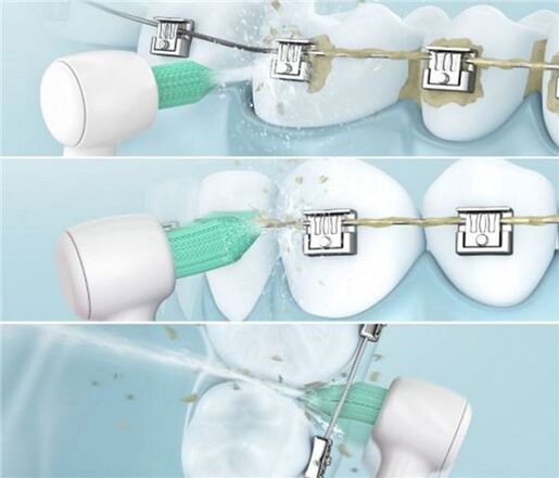 PANASONIC nastavak e četkica WEW0984W303