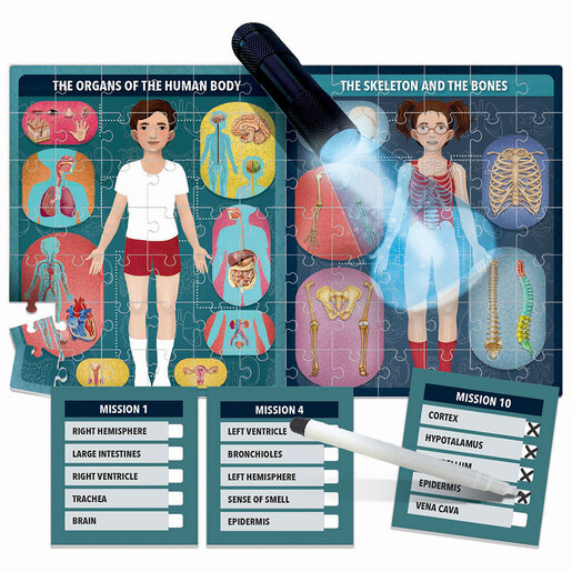 HEADU - Kako radi rendgen