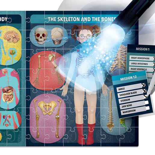 HEADU - Kako radi rendgen