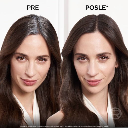 L'Oreal Paris Magic Retouch Sprej za prikrivanje izrastka 2 Dark Brown