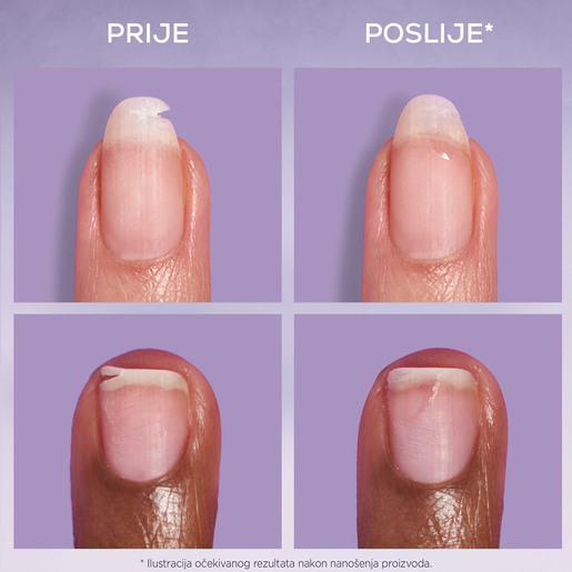 Essie Beak fix flaster za nokte