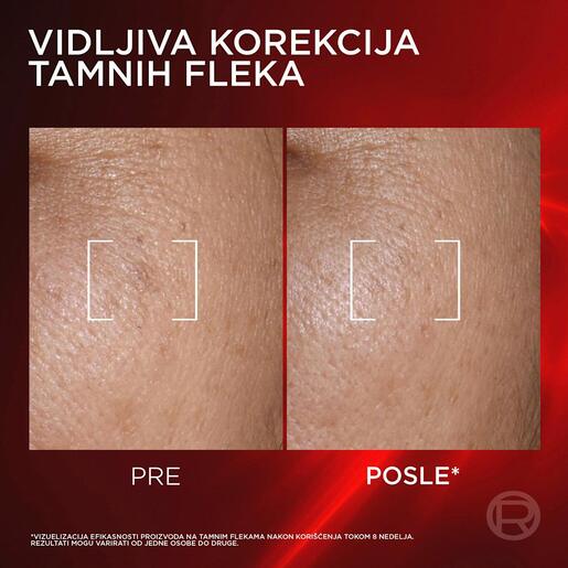 L'Oreal Paris Revitalift Laser triple laser kremasti serum