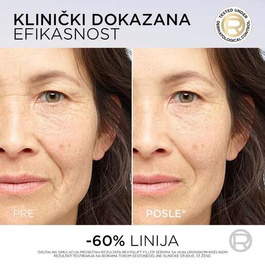 L'Oréal Paris Revitalift Filler Hijaluron PDRN+ hidrirajući serum protiv bora, 15ml